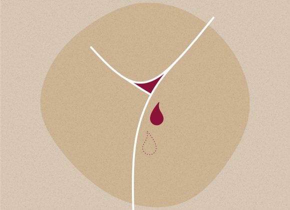6 Potential Reasons for Irregular Menstrual Cycles - Sparkle Blog