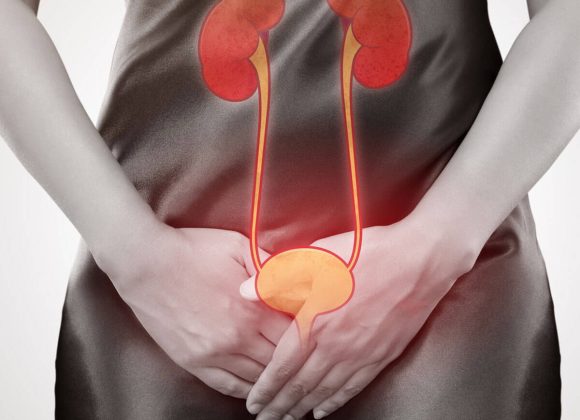 Profiling the most prolific (micro) pest: Urinary Tract Infection (UTI), Symptoms and Prevention Tips Profiling the most prolific (micro) pest: Urinary Tract Infection (UTI), Symptoms and Prevention Tips
