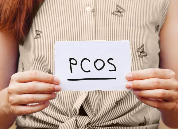 Breaking 5 Myths About PCOS